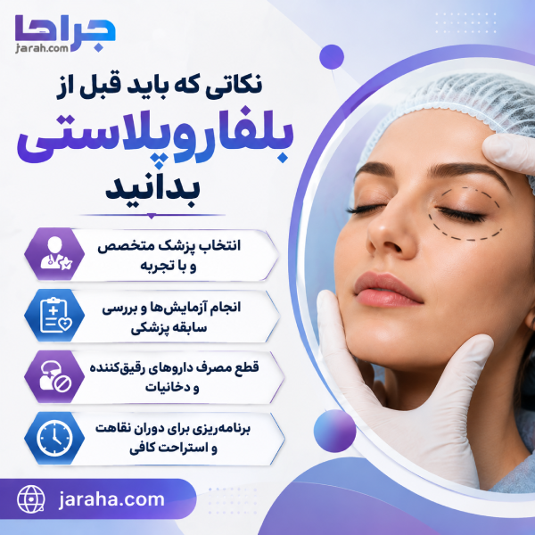 نکاتی که باید قبل از عمل بلفاروپلاستی بدانید
