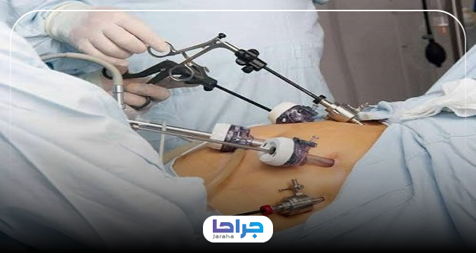 عوارض و خطرات بایپس معده