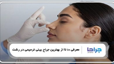 بهترین جراح بینی ترمیمی در رشت