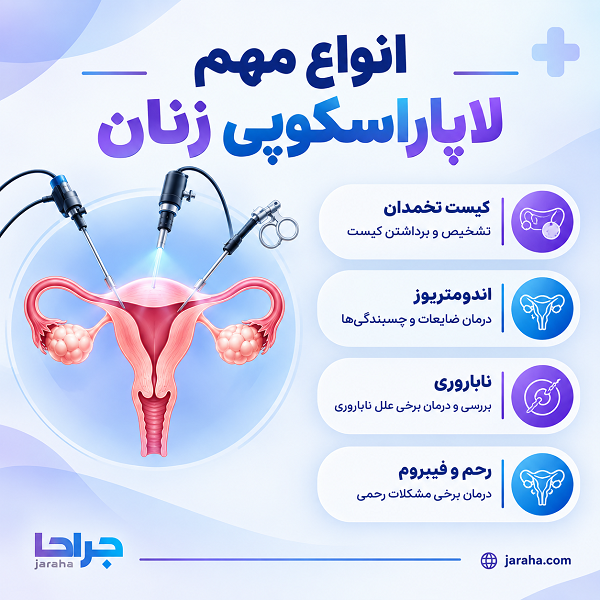انواع مهم لاپاراسکوپی زنان