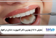 بهترین دکتر کامپوزیت دندان در اهواز