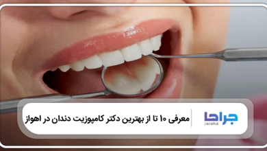 بهترین دکتر کامپوزیت دندان در اهواز