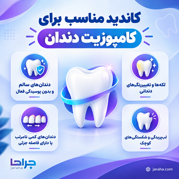 کاندید مناسب برای کامپوزیت دندان
