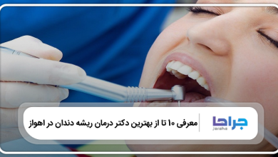 بهترین دکتر درمان ریشه دندان در اهواز