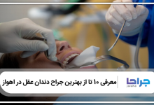 بهترین جراح دندان عقل در اهواز