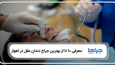بهترین جراح دندان عقل در اهواز