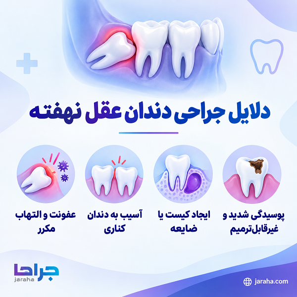 دلایل جراحی دندان عقل نهفته