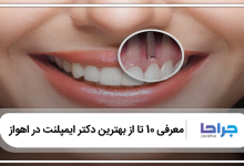 بهترین دکتر ایمپلنت در اهواز