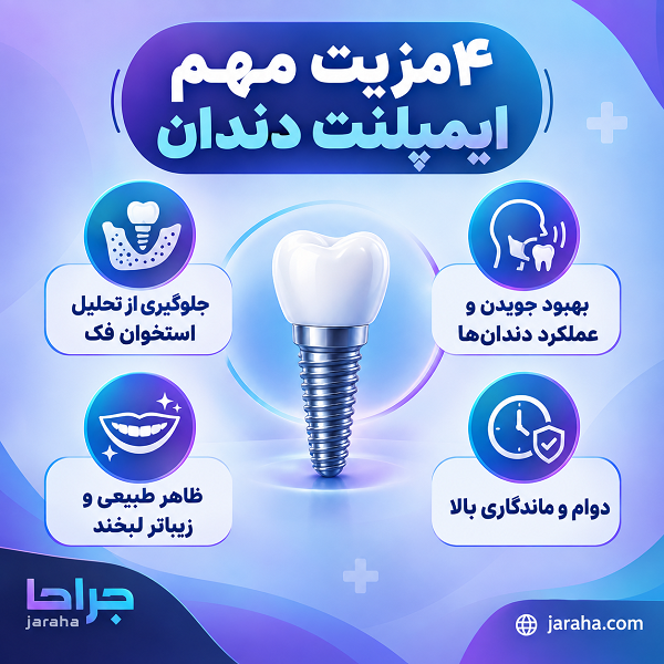 4 مزیت مهم ایمپلنت دندان