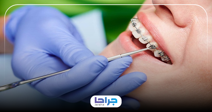 ارتودنسی دندان برای چه کسانی مناسب است؟