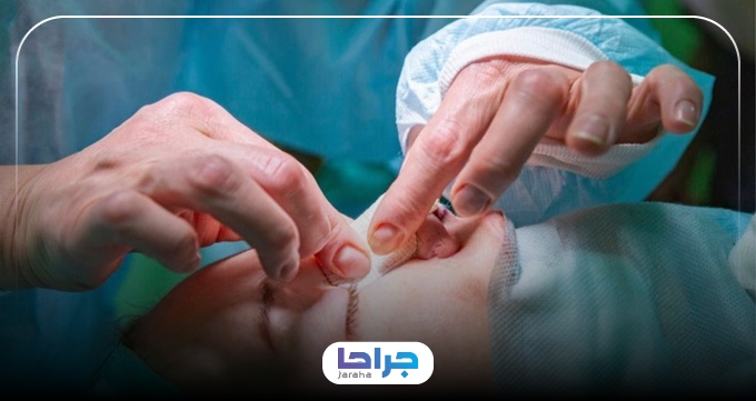 آیا بینی گوشتی بعد از عمل برمیگردد؟ دلایل و راههای جلوگیری