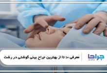 بهترین جراح بینی گوشتی در رشت