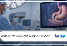بهترین جراح بایپس معده در تهران