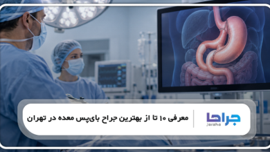 بهترین جراح بایپس معده در تهران