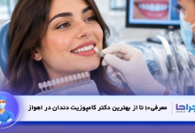 بهترین دکتر کامپوزیت دندان در اهواز؛ معرفی 10 متخصص برتر