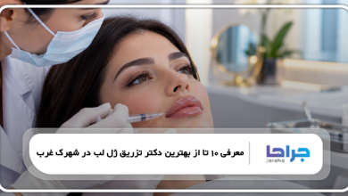 10 تا از بهترین دکتر تزریق ژل لب در شهرک غرب| نمونه کار