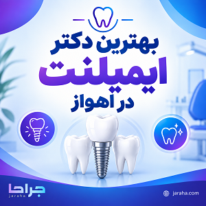 بهترین دکتر ایمپلنت در اهواز