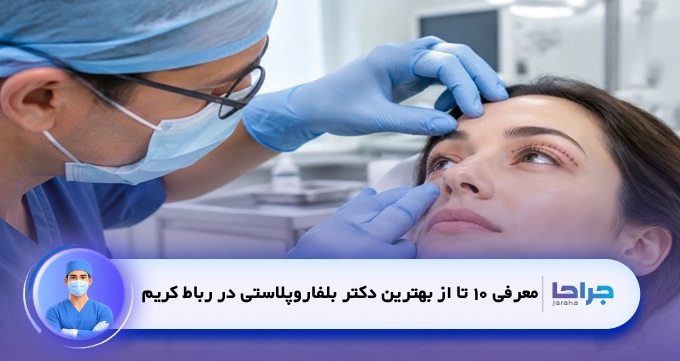بهترین دکتر بلفاروپلاستی در رباط کریم