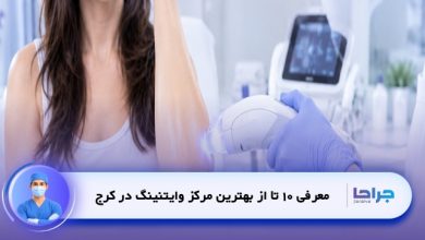 بهترین مرکز وایتنینگ در کرج