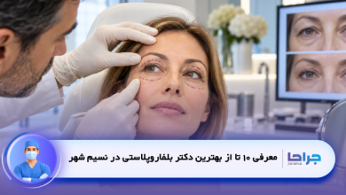بهترین دکتر بلفاروپلاستی در نسیم شهر